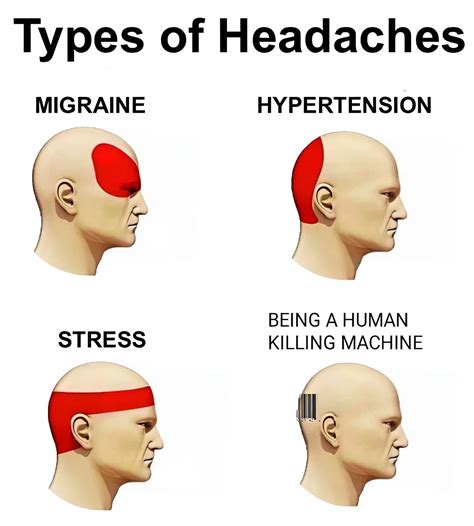 30+ Free Printable Headache Chart Templates [PDF]