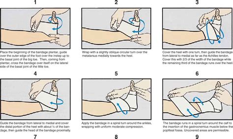 Image result for Applying a Compression Bandage