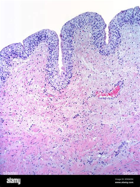 Mucosa of the urinary bladder formed by a transitional epithelium and a lamina propria of ...