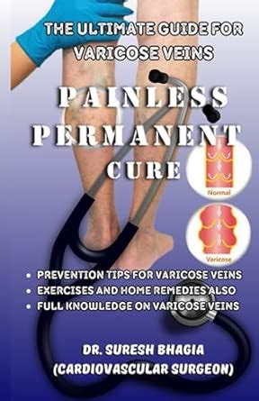 Buy The ultimate guide for Varicose veins: painless, permanent cure and ...