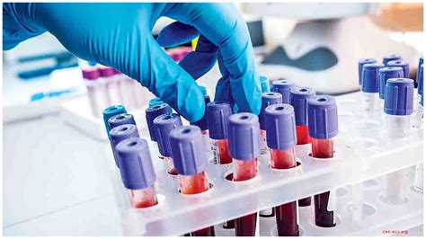 Maharashtra launches Project Platina for COVID Patients
