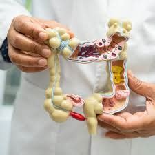 Gut Microbiome Test vs Stool Test: Which Is Better for Gut Imbalance ...