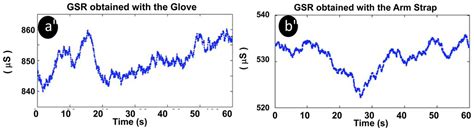Sensorized Garments and Textrode-Enabled Measurement Instrumentation ...