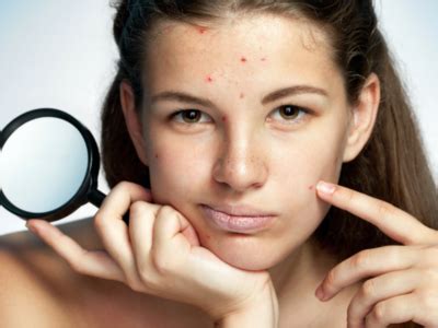 Consumption of this magical food can cure stubborn pimples - Times of India