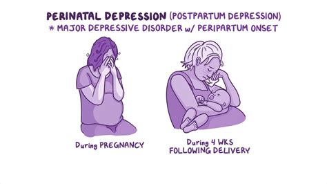 Video: Perinatal depression: Nursing | Osmosis