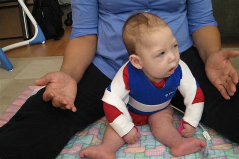 3个月正常婴儿与脑瘫患儿的运动对比有哪些？