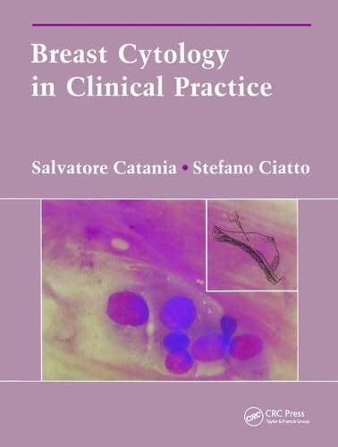 Breast Cytology In Clinical Practice : Catania S.: Amazon.in: Books