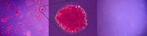 Cell Transformation Detection Assay The Cell Transformation Detection ...