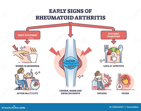 Early Signs of Rheumatoid Arthritis Disease and Joint Pain Outline Diagram Stock Vector ...