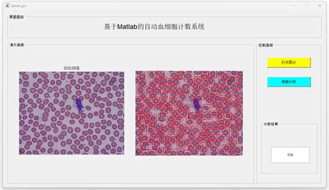 Blood GUI 的图像结果