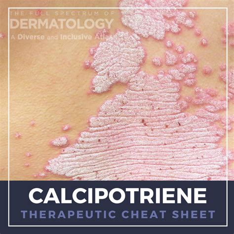 calcipotriene cream Archives - Next Steps in Dermatology