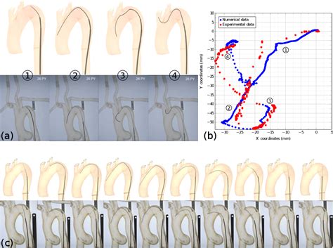 Image result for Multi Dynamic Vena Modeling