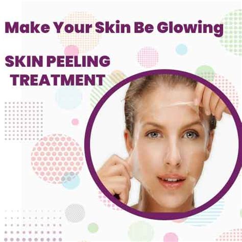 Skin Peeling treatment|Chemical Peel Treatment in Surat, Gujarat, India