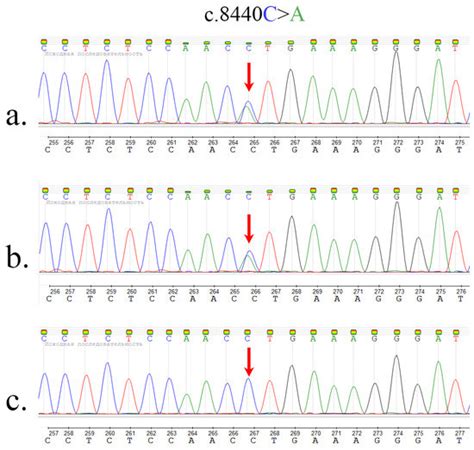 Description of the First Registered Case of Lopes–Maciel–Rodan Syndrome ...