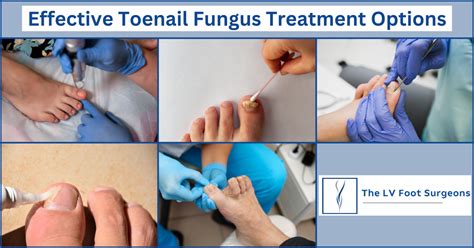 The best toenail fungus treatment for 2026, according to dermatologists Aesthetic