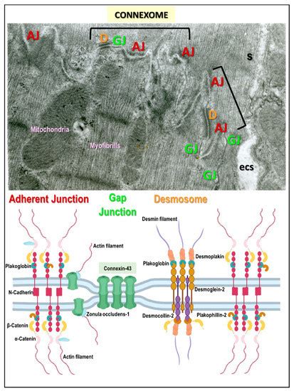 Hypertension Induces Pro-arrhythmic Cardiac Connexome Disorders ...