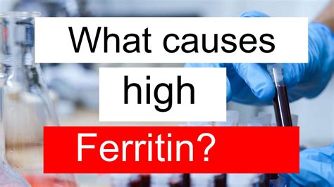 What causes high Ferritin and low TIBC?