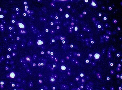 Fig. 3: Optical view of loaded optimum CSNPs formula (F15)