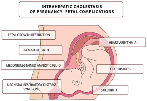 Intrahepatic Cholestasis Of Pregnancy