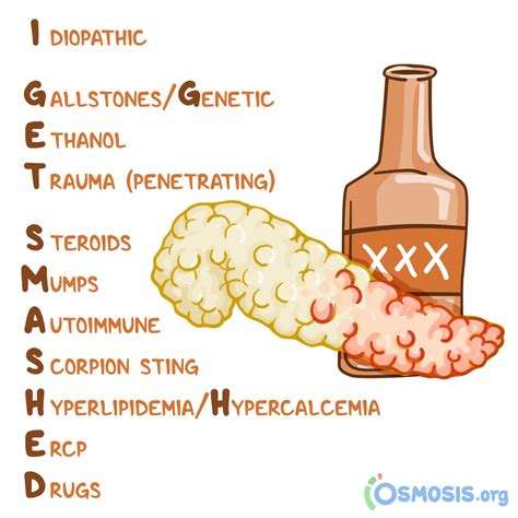 The Top 10 Helpful Medical Mnemonics from Osmosis - Osmosis Blog