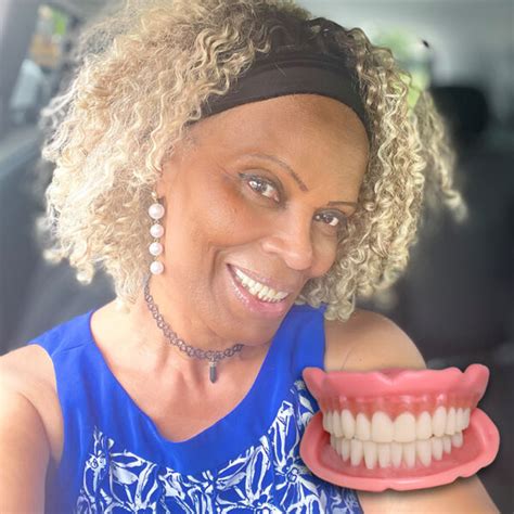 Image result for Denture Fitting Tips