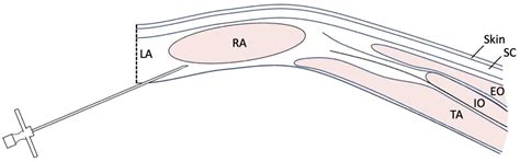 Open Approach to the Transversus Abdominis Plane in Horses: A Cadaver ...