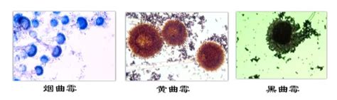 MPB：北林张静等-丛枝菌根真菌(AMF)孢子、菌丝密度及侵染率定量测定方法-CSDN博客