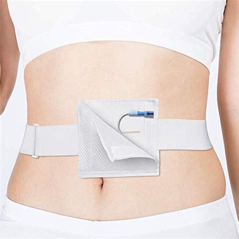 Feeding Tube Peritoneal Dialysis G Tube Belt G-Tube India | Ubuy
