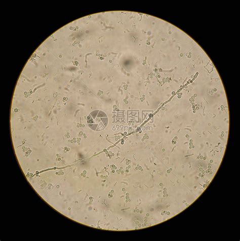 天然制剂中白色念珠菌的显微镜观察高清图片下载-正版图片505857351-摄图网