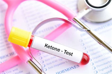 Ketones Test:कीटोन टेस्ट क्या है?कैसे किया जाता है? - हैलो स्वास्थ्य