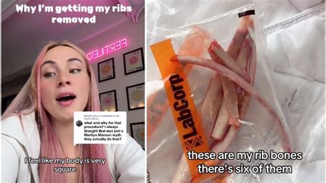US influencer spends Rs 14 lakh on rib removal - US influencer spends ...