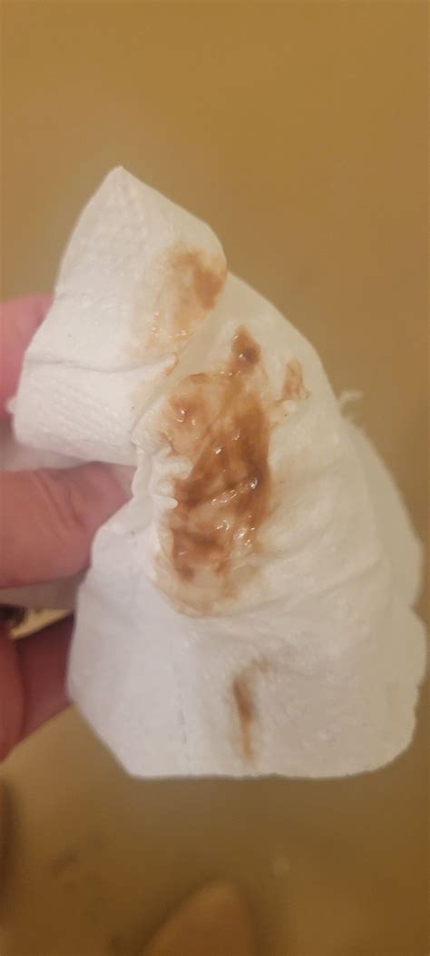 Light Brown Creamy Discharge During Early Pregnancy at Clara Stamps blog