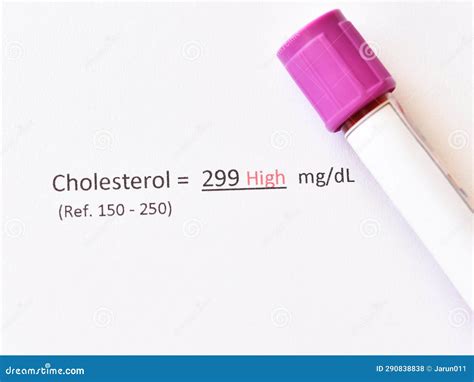 Abnormal High Cholesterol Result Stock Photo - Image of panel, serum: 290838838