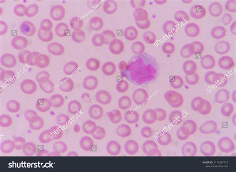 Image result for Monocyte Under Microscope