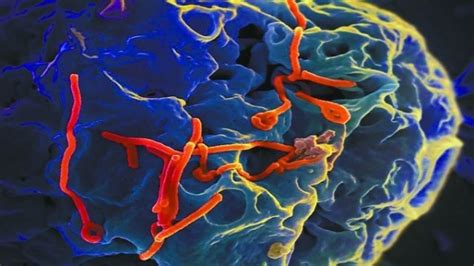 感染埃博拉病毒图片-绿色背景的埃博拉病毒素材-高清图片-摄影照片-寻图免费打包下载