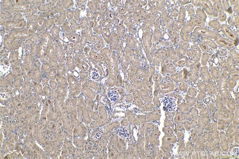 IHCeasy LOX Ready-To-Use IHC Kit KHC0630 | Proteintech