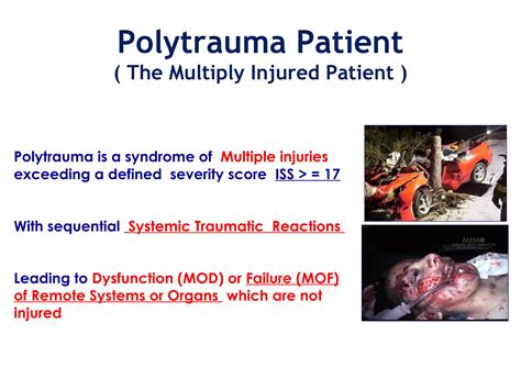 Polytrauma part 1 (overview) | PPT