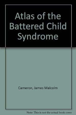 Buy Atlas of the Battered Child Syndrome Book Online at Low Prices in ...
