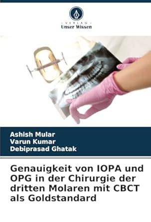 Buy Genauigkeit von IOPA und OPG in der Chirurgie der dritten Molaren ...
