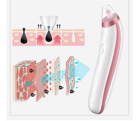 Buy MXIAOXIAO Electric Acne Scavenger Spot Tool Vacuum Extractor Dark ...