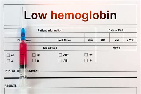 Shots For Low Hemoglobin , Types of Treatment for Chemo-Induced Anemia – CASZ