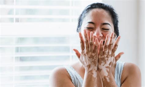 Skin Treatments - Botanikx Clinic