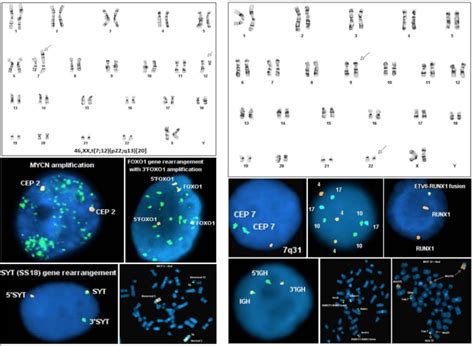 Cancer Cytogenetics Core Laboratory | Texas Children's