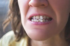 Image result for Teeth