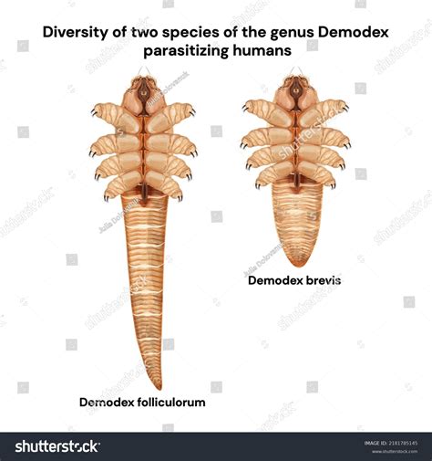 55 Demodex Mite Stock Vectors and Vector Art | Shutterstock