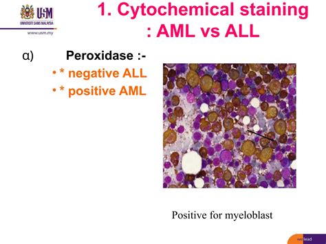 8. Acute leukaemia (Diagnostic approach) | PPTX