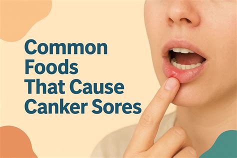 10 Common Foods That Cause Canker Sores You Should Avoid