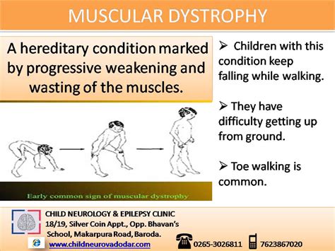 Child Neurologist | Pediatric Neurologist | Child Neurology | Epilepsy ...