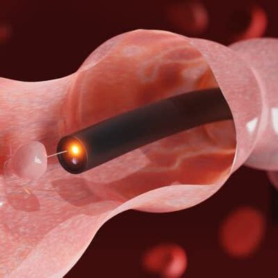 Endoscopy Cost in Mumbai: Affordable Treatment Options
