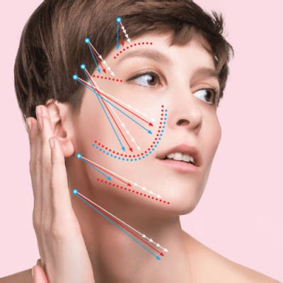 Image result for Thread Lift Procedure YouTube